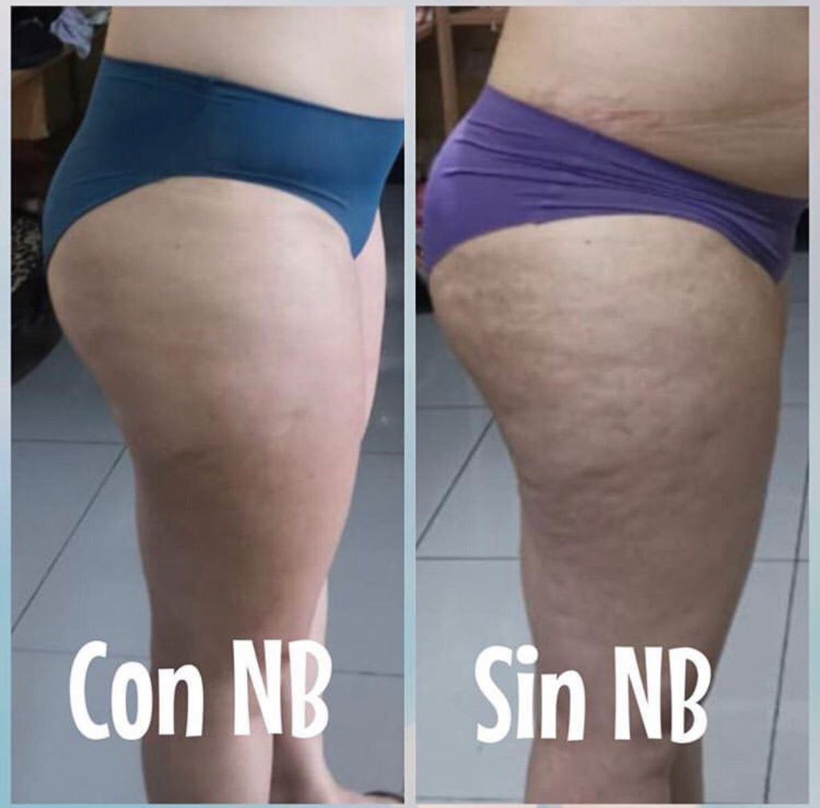 Nalguitas Bonitas: La Prueba del Cambio Radical en Solo Dos Meses