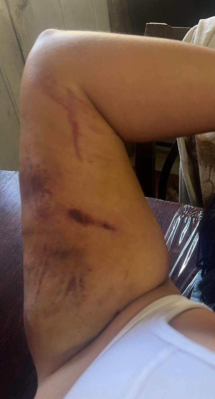 Después de una mala praxis, encontré esperanza en un frasquito: Nalguitas Bonitas - Nalguitas Bonitas